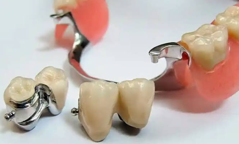 denture repair near me